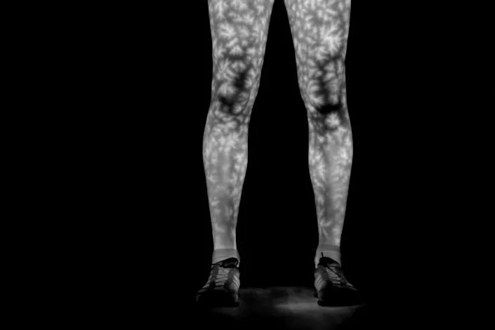 Vessel-associated heat distribution patterns on the body surface