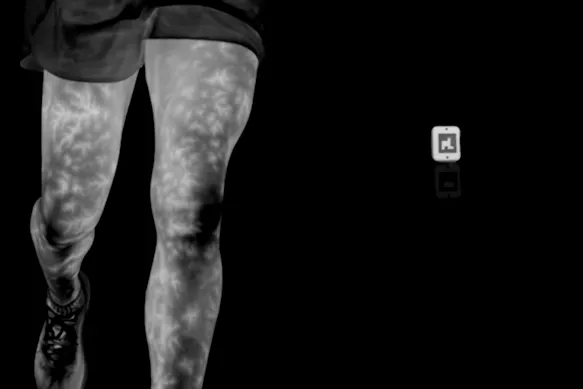 Vessel-associated heat distribution patterns on the legs surface while running