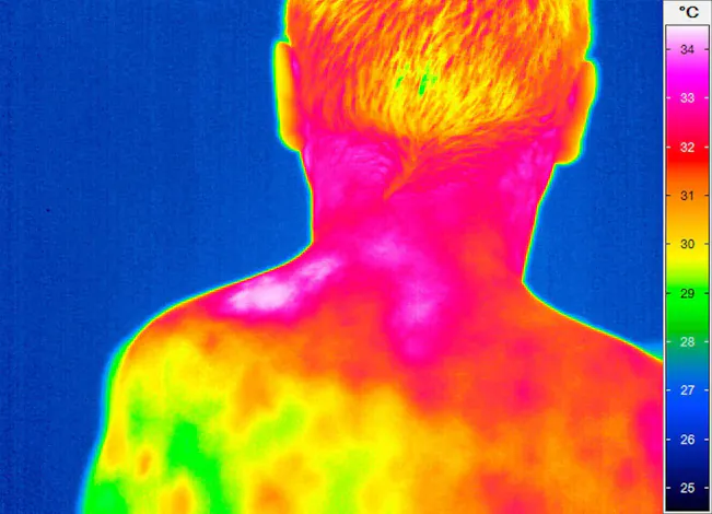 Thermal imaging of a back