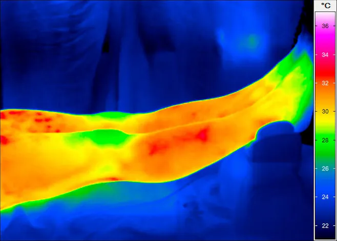 Thermal imaging of legs